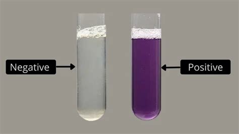 biuret test positive and negative results